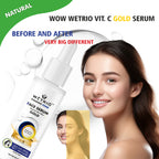 Foaming Face Serum – Gold | Brightening Face Serum with Vitamin C & Niacinamide